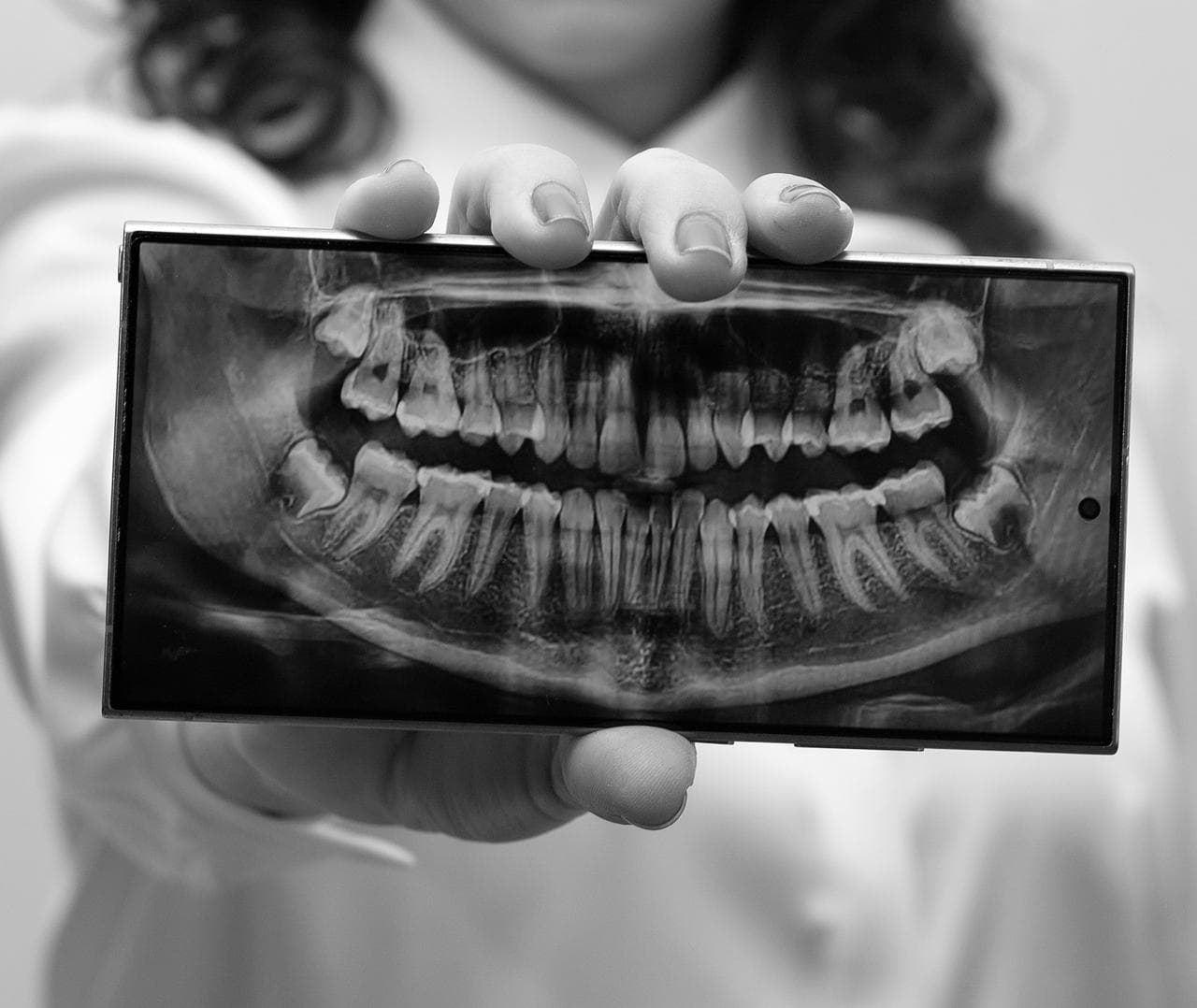 Panoramic dental X-ray film held up for review at The Smile Suite