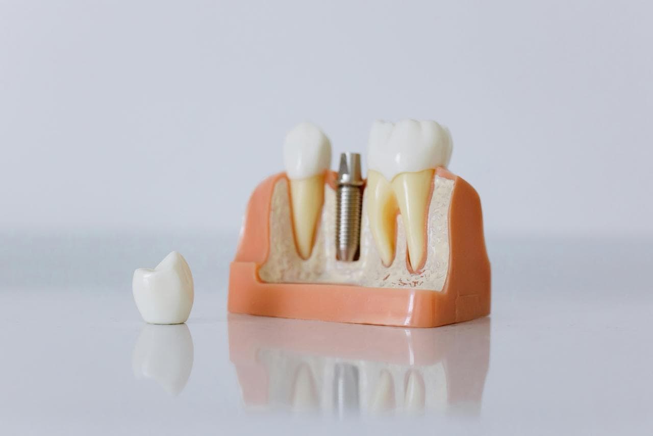 Dental services at The Smile Suite in Midland, Texas